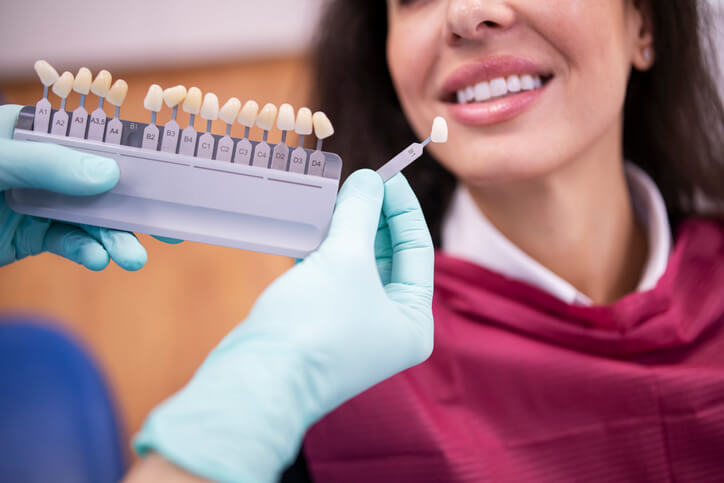 veneers in Palmdale